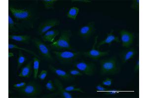 Immunofluorescence of monoclonal antibody to PDCL3 on HeLa cell. (PDCL3 抗体  (AA 1-239))