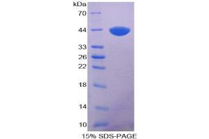 SDS-PAGE analysis of Human Keratin 5 Protein.