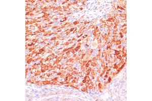 Immunohistochemistry of paraffin-embedded rat ovary using ASNS antibody (ABIN7265693) at dilution of 1:100 (40x lens). (Asparagine Synthetase 抗体  (AA 262-561))