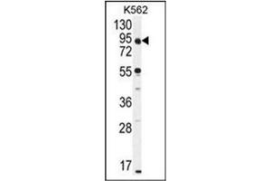 Western blot analysis of CCDC128 Antibody (Center) in K562 cell line lysates (35ug/lane). (KLRAQ1 抗体  (Middle Region))