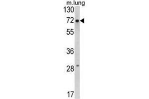 Western blot analysis of FMR1 Antibody (N-term) in mouse lung tissue lysates (35 µg/lane). (FMR1 抗体  (N-Term))