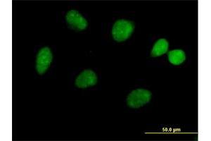 Immunofluorescence of purified MaxPab antibody to FLJ13798 on HeLa cell. (JMJD5 抗体  (AA 1-416))