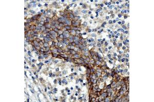 IHC analysis of EGFR using anti-EGFR antibody (ABIN7601478). (EGFR 抗体  (AA 36-497))