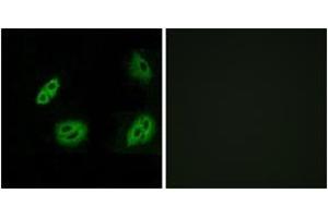 Immunofluorescence analysis of A549 cells, using OR4B1 Antibody. (Olfactory Receptor 4B1 (OR4B1) (AA 260-309) 抗体)