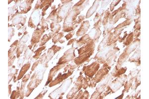 Formalin-fixed, paraffin-embedded human Cardiac Muscle stained with Sarcomeric Actinin Alpha 2 Mouse Monoclonal Antibody (ACTN2/3294). (ACTN2 抗体  (AA 557-692))