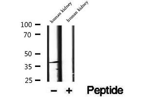 Western blot analysis of extracts of human kidney tissue, using DYNC2LI1 antibody. (DYNC2LI1 抗体  (Internal Region))