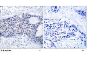 Image no. 1 for anti-zeta-Chain (TCR) Associated Protein Kinase 70kDa (ZAP70) (pTyr493) antibody (ABIN196887) (ZAP70 抗体  (pTyr493))