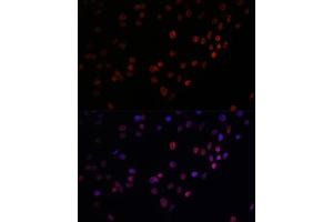 Immunofluorescence analysis of C6 cells using Matrin 3 antibody (ABIN7268415) at dilution of 1:100. (MATR3 抗体  (AA 747-847))