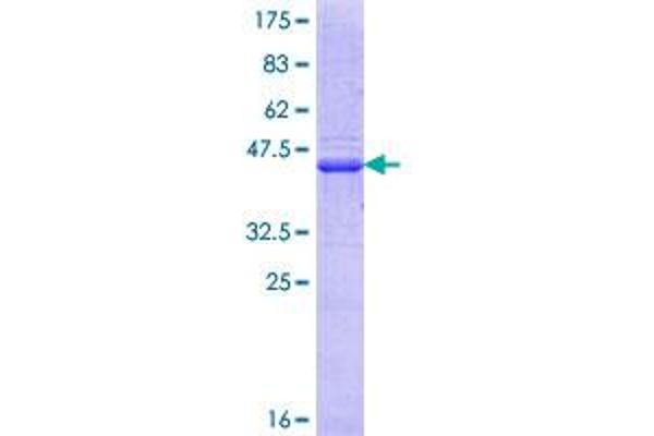 USP7 Protein (AA 13-110) (GST tag)
