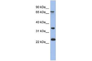 WB Suggested Anti-TBC1D25 Antibody Titration: 0. (TBC1D25 抗体  (N-Term))