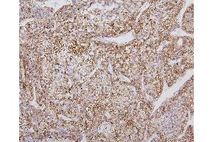 IHC analysis of CYP2E1 using anti-CYP2E1 antibody (ABIN7601446).