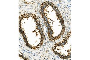 IHC analysis of Hexokinase 1/HK1 using anti-Hexokinase 1/HK1 antibody (ABIN7600259).
