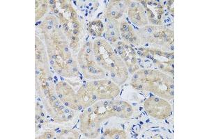 Immunohistochemistry of paraffin-embedded rat kidney using STK3 antibody. (STK3 抗体  (AA 323-450))