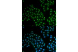 Immunofluorescence analysis of A549 cells using SOX2 antibody (ABIN5970209). (SOX2 抗体)