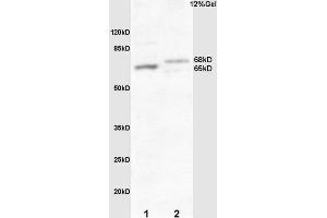 L1 mouse embryo lysate L2 human colon carcinoma lysates probed with Rabbit Anti-Frizzled 10/CD350 Polyclonal Antibody, Unconjugated  at 1:3000 for 90 min at 37˚C. (FZD10 抗体  (AA 101-200))