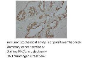 Staining with PRKCA antibody (PKC alpha 抗体  (C-Term))