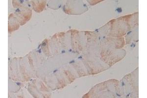 Detection of PLA2R1 in Mouse Skeletal muscle Tissue using Polyclonal Antibody to Phospholipase A2 Receptor 1 (PLA2R1) (PLA2R1 抗体  (AA 1418-1487))