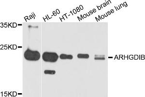 Western blot analysis of extracts of various cell lines, using ARHGDIB antibody.