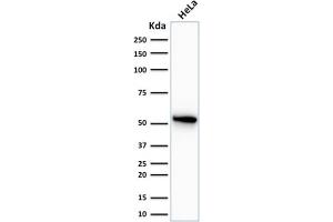 Western Blot Analysis of human HeLa cell lysate using Cytokeratin 7 Mouse Monoclonal Antibody (OV-TL12/30). (Cytokeratin 7 抗体)