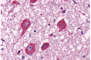 Anti-GPR40 antibody  ABIN1048820 IHC staining of human brain, neurons. (FFAR1 抗体  (C-Term))