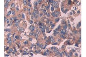 Used in DAB staining on fromalin fixed paraffin- embedded stomach cancer tissue (IL-24 抗体  (AA 51-206))