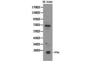 Western Blotting (WB) image for anti-Interferon gamma (IFNG) antibody (ABIN1873153) (Interferon gamma 抗体)