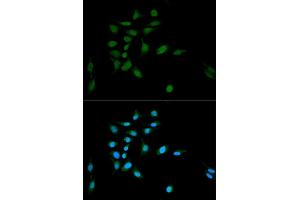 Immunofluorescence analysis of U2OS cells using PSMA1 antibody (ABIN5971354) at dilution of 1/100. (PSMA1 抗体)