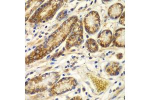 Immunohistochemistry of paraffin-embedded human colon using CAPNS1 antibody. (Calpain S1 抗体  (AA 69-268))
