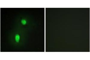 Immunofluorescence analysis of HuvEc cells, using hnRNP C1/C2 Antibody. (HNRNPC 抗体  (AA 241-290))