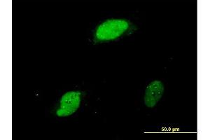 Immunofluorescence of monoclonal antibody to EGR1 on HeLa cell. (EGR1 抗体  (AA 444-543))