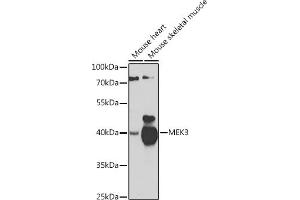 Western blot analysis of extracts of various cell lines, using MEK3 antibody (ABIN6130544, ABIN6143484, ABIN6143485 and ABIN6223650) at 1:1000 dilution. (MAP2K3 抗体  (AA 1-170))