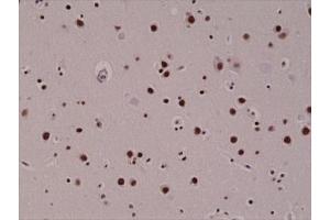 IHC testing of FFPE human brain with recombinant 5hmC antibody. (Recombinant 5-Hydroxymethylcytosine 抗体)