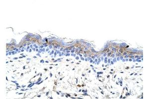 IRX3 antibody was used for immunohistochemistry at a concentration of 4-8 ug/ml to stain Squamous epithelial cells (arrows) in Human Skin. (IRX3 抗体  (C-Term))
