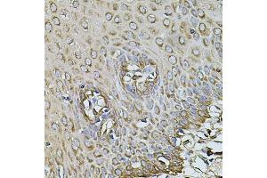 Immunohistochemistry of paraffin-embedded human esophagus using CPOX antibody (ABIN1871988) at dilution of 1:100 (40x lens). (CPOX 抗体)