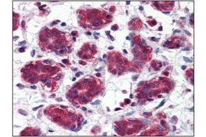 Immunohistochemistry (IHC) image for anti-Folate Hydrolase (Prostate-Specific Membrane Antigen) 1 (FOLH1) (AA 117-351) antibody (ABIN317554) (PSMA 抗体  (AA 117-351))