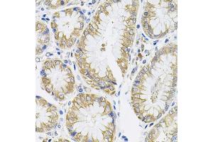Immunohistochemistry of paraffin-embedded human stomach using IL13 antibody (ABIN3022881, ABIN3022882, ABIN3022883 and ABIN6219278) (40x lens).
