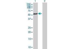 Western Blot analysis of AKT1 expression in transfected 293T cell line by AKT1 MaxPab polyclonal antibody. (AKT1 抗体  (AA 1-480))