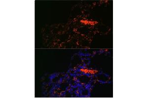 Immunofluorescence (IF) image for anti-ATP-Binding Cassette, Sub-Family G (WHITE), Member 1 (ABCG1) (AA 1-220) antibody (ABIN1678514)