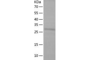 NSP5 Protein (AA 458-761) (His tag)