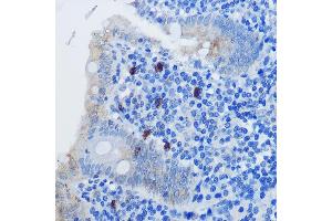 Immunohistochemistry of paraffin-embedded human appendix using IL8 Rabbit pAb (ABIN3016225, ABIN3016226, ABIN3016227 and ABIN6219634) at dilution of 1:100 (40x lens). (IL-8 抗体  (AA 21-99))