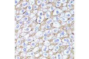 Immunohistochemistry (Paraffin-embedded Sections) (IHC (p)) image for anti-Major Histocompatibility Complex, Class I, A (HLA-A) (AA 35-285) antibody (ABIN3023100)