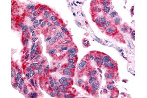 Immunohistochemistry (IHC) image for anti-Olfactory Receptor, Family 6, Subfamily N, Member 1 (OR6N1) (Extracellular Domain) antibody (ABIN1049187)