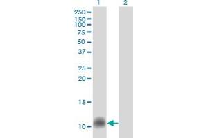 Western Blot analysis of CCL14 expression in transfected 293T cell line by CCL14 monoclonal antibody (M01), clone 1F12. (CCL14 抗体  (AA 20-93))