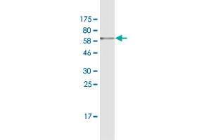 Western Blot detection against Immunogen (58. (Phosducin-Like 抗体  (AA 1-301))