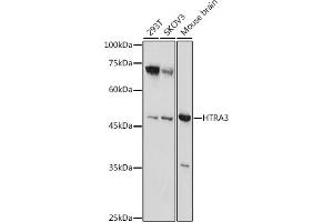 Western blot analysis of extracts of various cell lines, using HTR antibody (ABIN7267790) at 1:1000 dilution. (HTRA3 抗体  (AA 334-453))