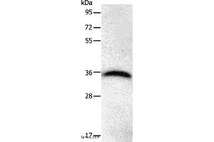Western blot analysis of Hela cell, using PPP1CB Polyclonal Antibody at dilution of 1:450 (PPP1CB 抗体)