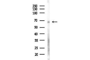 anti-HKR1, GLI-Kruppel Zinc Finger Family Member (HKR1) antibody