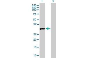 Western Blot analysis of CAPZA3 expression in transfected 293T cell line by CAPZA3 MaxPab polyclonal antibody. (CAPZA3 抗体  (AA 1-299))