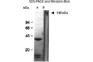 Western Blotting (WB) image for anti-Aggregation Factor antibody (ABIN191910) (Aggregation Factor 抗体)