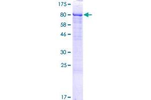 LTV1 Protein (AA 1-475) (GST tag)